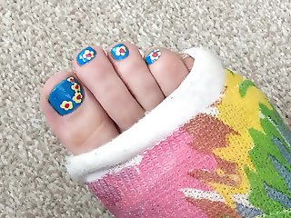 Toe Nail Art with cast