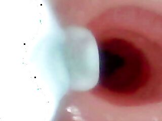 A detailed examination of Lopuza93 oral cavity and anal area using an endoscope camera.