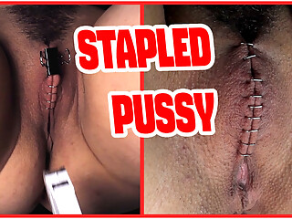 Sadistic doctor closes and staples his patient's pussy