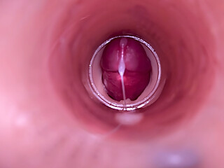 Female Insemination - Internal Camera Captures Deep Male Ejaculation