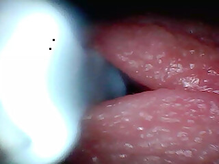 Endoscope camera captures moment of male ejaculation