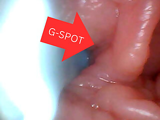 First time: An endoscope reveals the G-spot up close - without mountingl