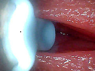 I couldn't believe what happens INSIDE the penis as sperm passes through (endoscopic footage)